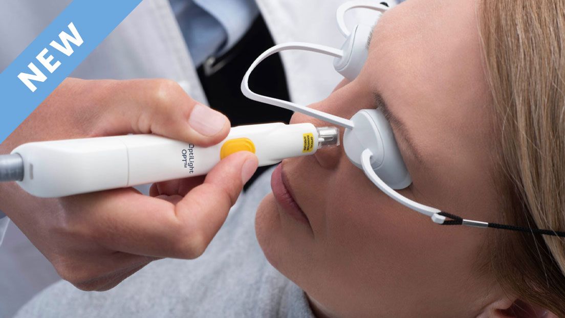 Lumenis OptiLight IPL Therapy