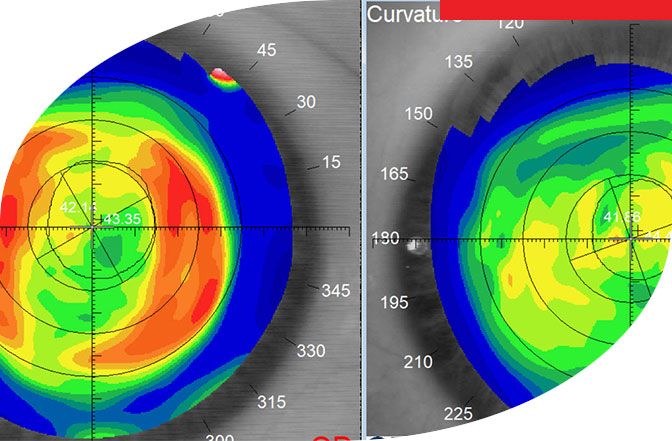 Ortho-k Eye Specialist in The Woodlands